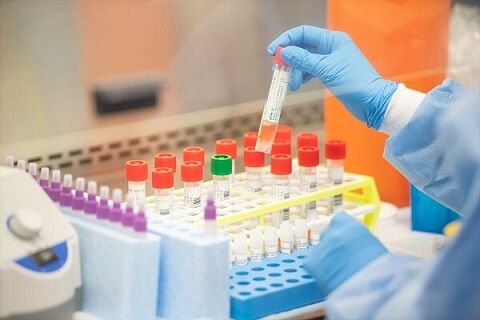 موفقیت شرکت‌های دانش بنیان در تولید کیت تشخیص کرونا